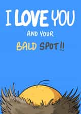 Funny Anniversary/Birthday Card - Bald Spot - For Him - Balding created by Bryony Jackson Walters