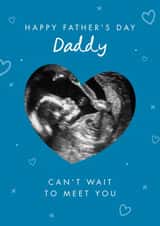 Personalised Father's Day Photo Card created by The Cake Thief - Cute Ultrasound 1st Father's Day Photo Card For Daddy From The Bump