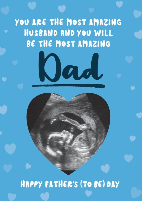 Cute Father's Day Card - Dad To Be - Pregnancy Scan created by Bev O'Connor || @oconnordesign